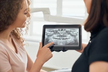 Por que fazer Raio-X dos dentes?